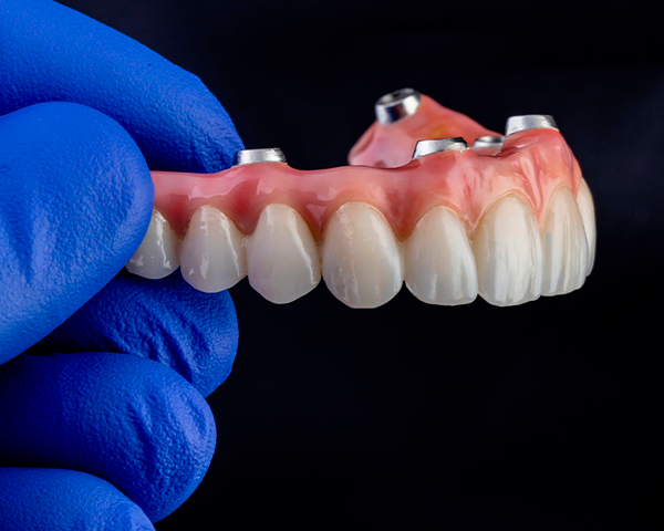Protocolo sobre Implantes